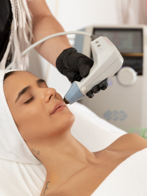 Exilis Elite facial
