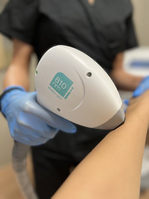 Epilare definitiva Elysion PRO+